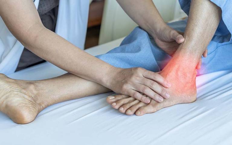 ankle pain stock image