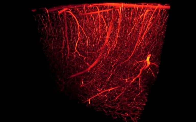 blood vessels 3d rendering