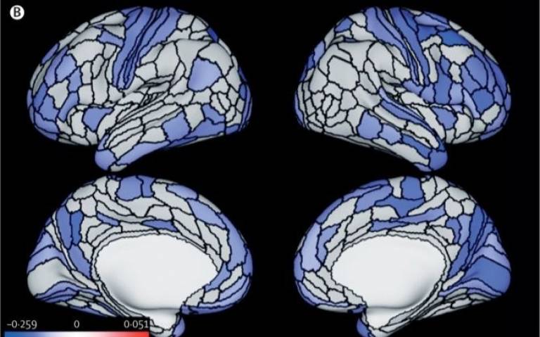 Brain scan composite