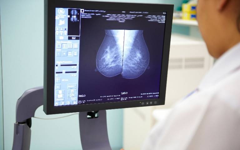 International trial included 2,298 women aged 45 or over with breast cancer