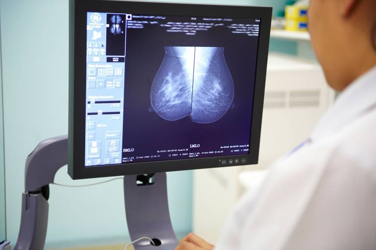 Radiographer looking at mammogram
