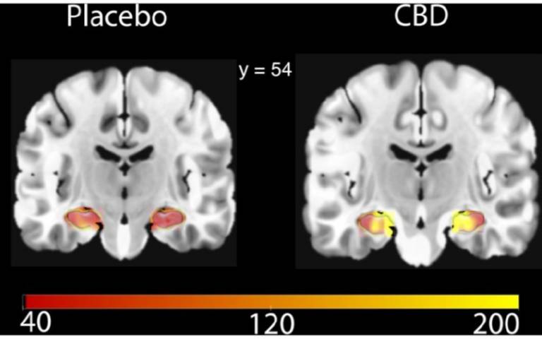 Differences in hippocampal blood flow after CBD or placebo