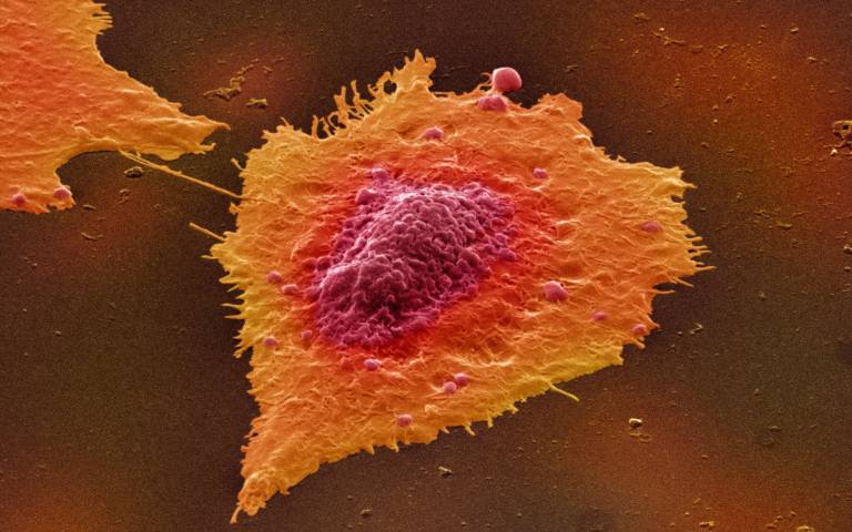 human colon cancer cells