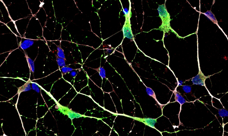 A control medium spiny neuron culture fixed at day 36 and stained with DARPP32 (green), CTIP2 (red), β3Tubulin (white) and DAPI (blue).