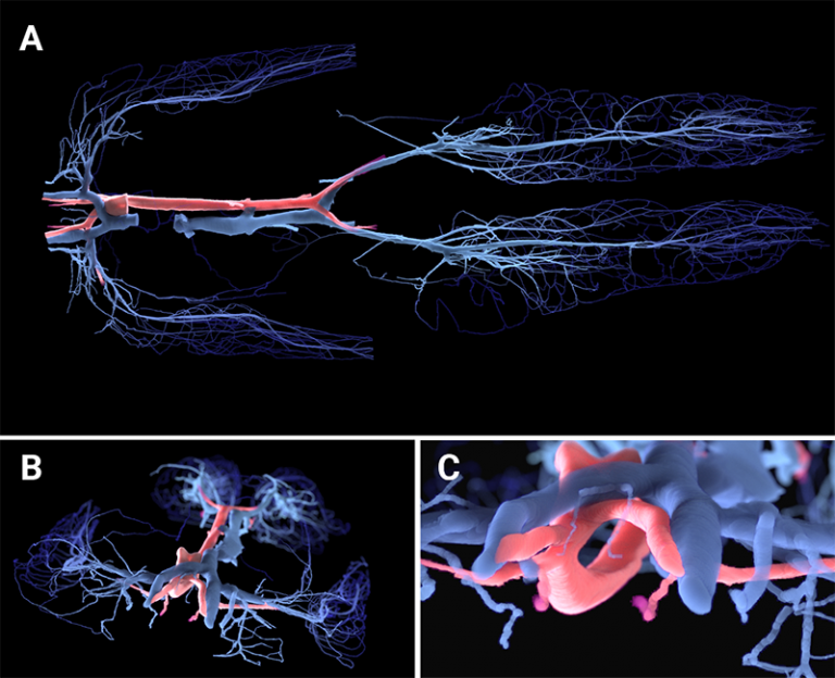 digital replica of blood vessels in the brain
