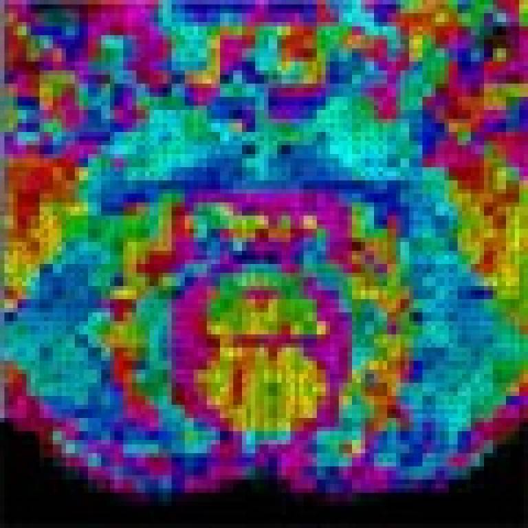 Microstructure imaging