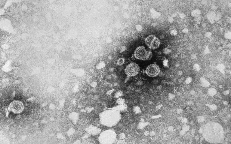 Transmission electron microscopic image revealed the presence of HBV particles
