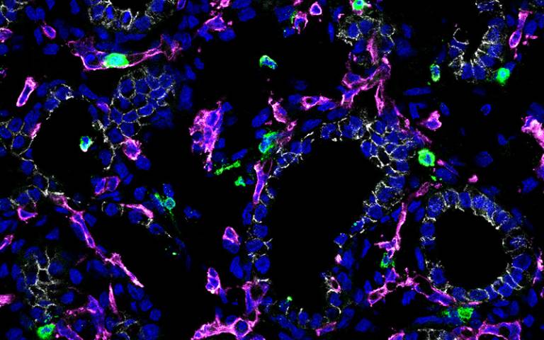 Immune cells could offer new avenues for treating respiratory diseases 