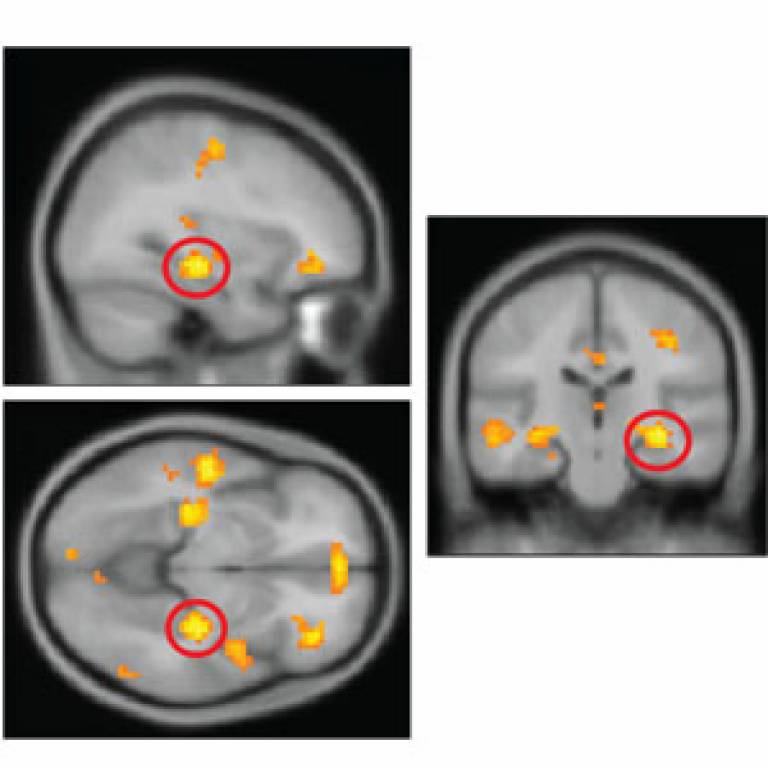 Hippocampus activity seen when forming event memories
