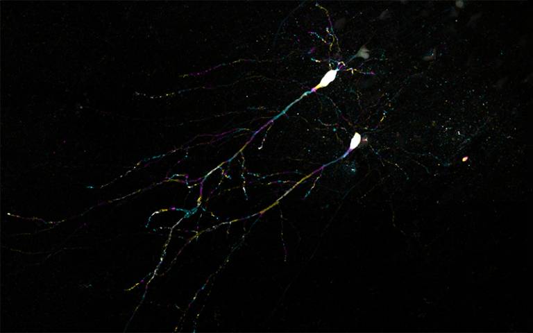 Mouse hippocampus neurons