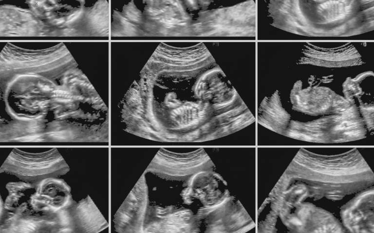 Unborn babies could contract Covid-19 says study, but it would be uncommon