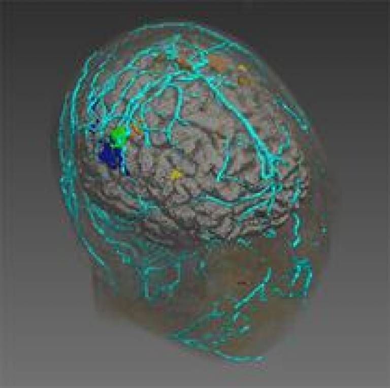 Medical Image Computing brain