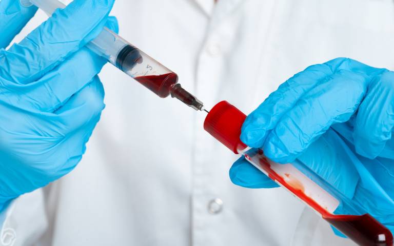 A doctor in blue gloves holds a test tube and syringe containing blood. Credit: FabrikaCr / iStock