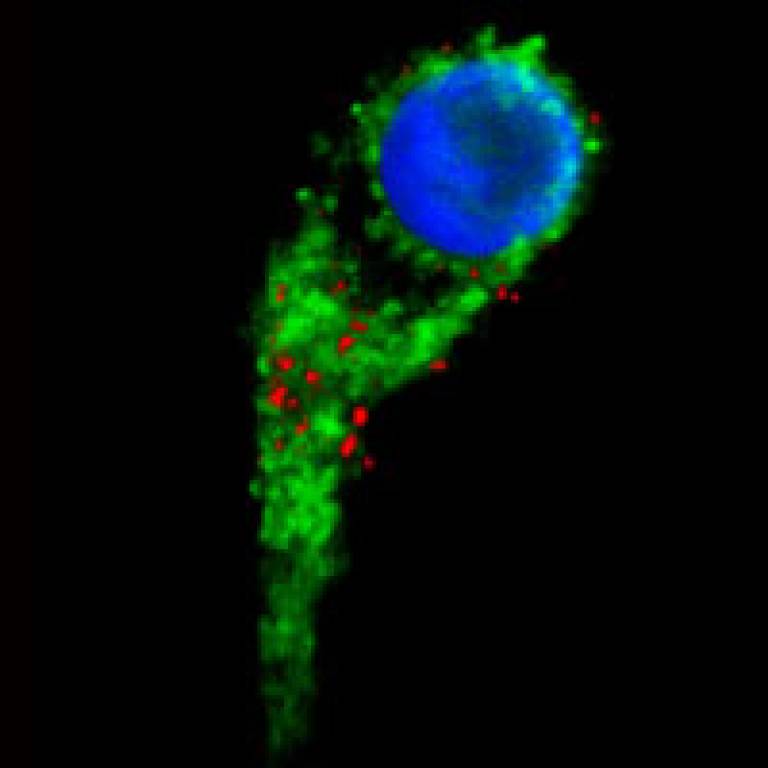 A human cell (green cytoplasm, blue nucleus) loaded with mini-magnets