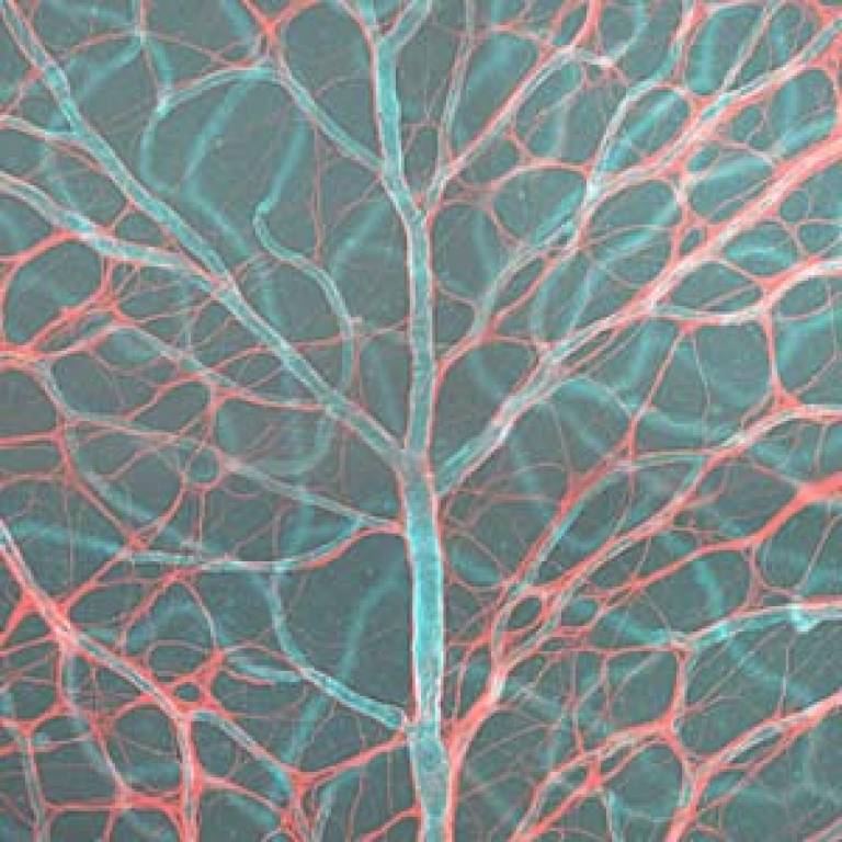 Blood vessels and glia cells in the human retina