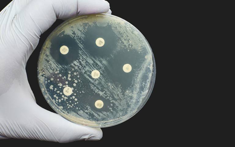 image of petri dish illustrating antimicrobial susceptibility testing