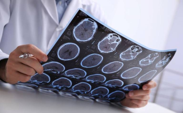 doctor assessing brain tumours