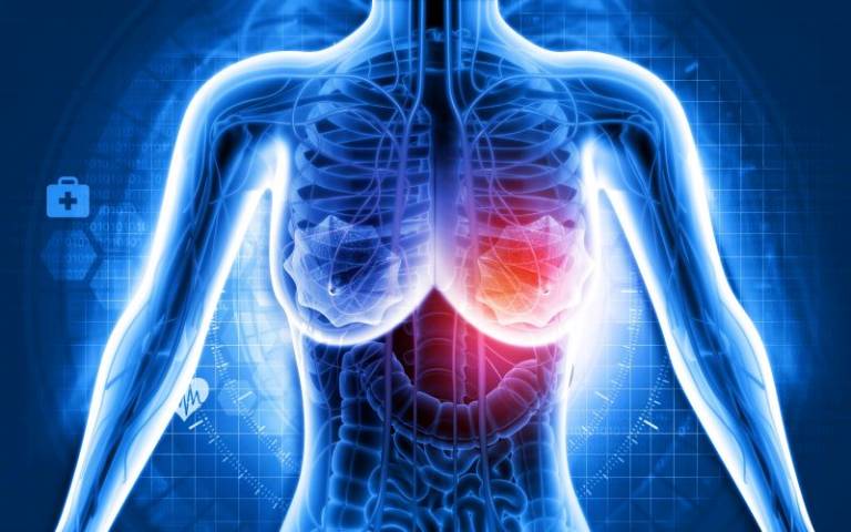 Scientists Create Tailored Drug for Aggressive Breast Cancer