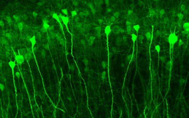 cfos-GFP hippocampal neurons activated by an epileptic seizures”. Credit: Benito Maffei