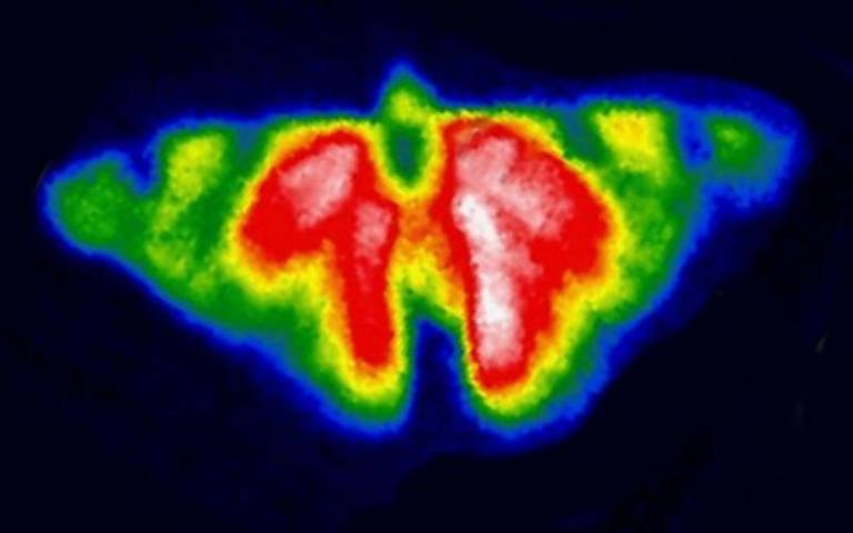 Red admiral thermograph