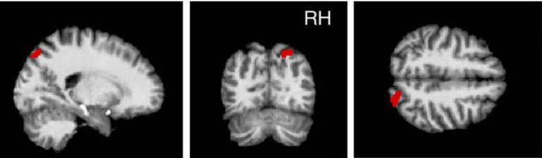 rPPC grey matter volume accounts for risk tolerance after controlling for age.