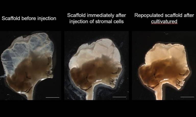 Stages of thymus scaffold: Human stromal cell repopulation
