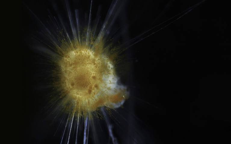 A living foraminifera in culture, surrounded by a halo of symbiotic algae along its spines (in golden dots). Fluffy material in the background is an Artemia nauplius that the foraminifera is eating. Credit: Daniel Gaskell