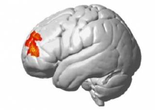 brain with left frontopolar region highlighted