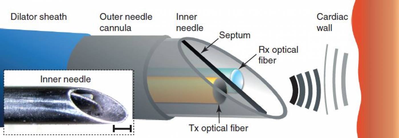 needle diagram