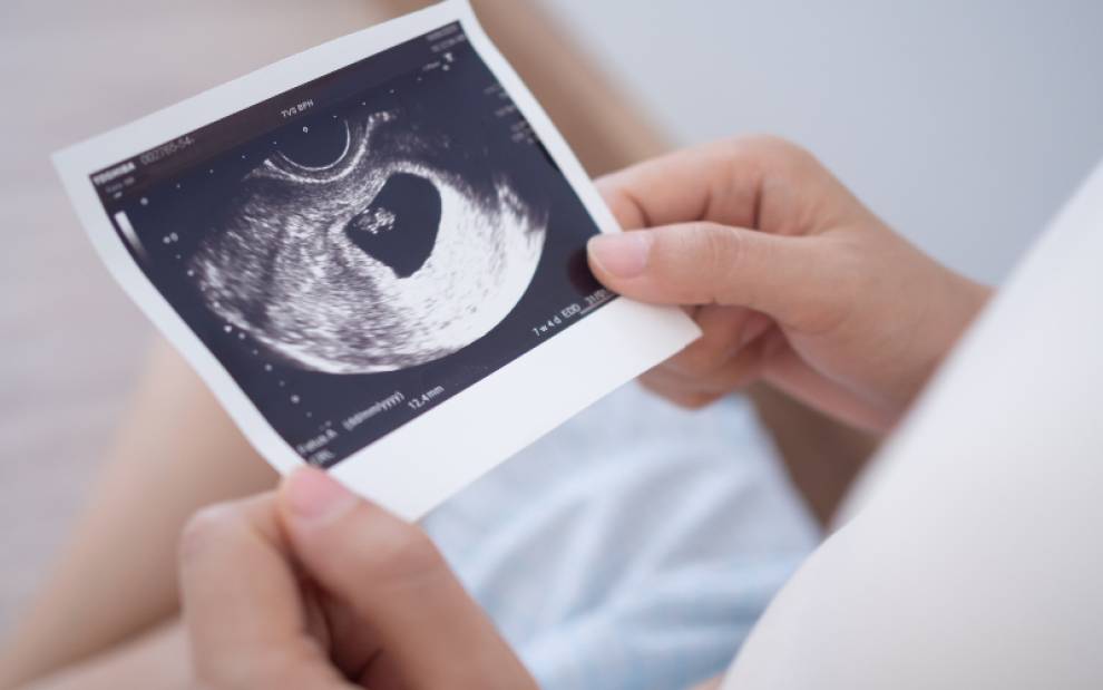 woman looks at an ultrasound scan