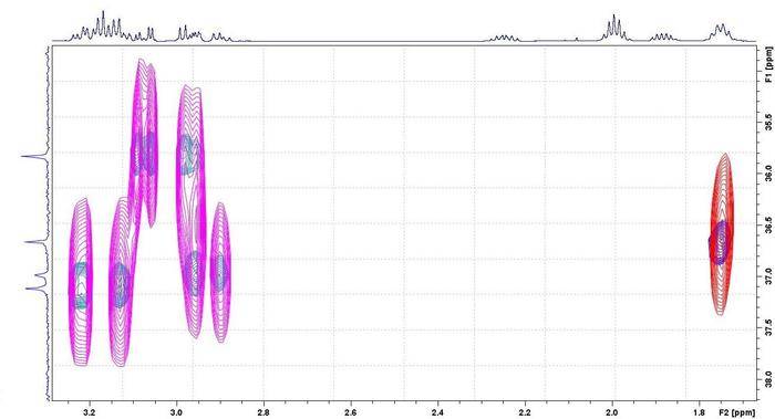 Comparison of normal (pink/red) and NUS (green/blue) HSQC spectra showing larger area than above.