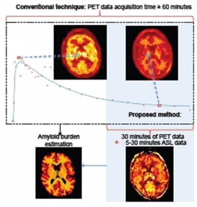 Schematic of conventional dynamic PET acquisition time for pharmacokinetic modelling to estimate amyloid burden and the reduced time required for the proposed method