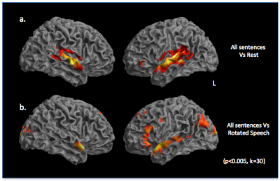 brain image for linguistics resesarch