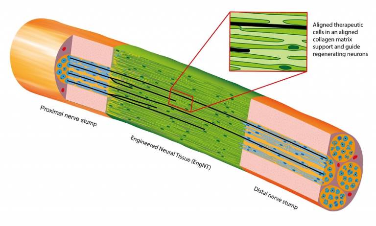 Diagram showing how EngNT provides a bridge of aligned therapeutic cells, which support and guide regenerating neurons across a gap in a damaged nerve