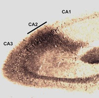 Characterisation of the CA2 region using a- actinin2 immunoperoxidase staining