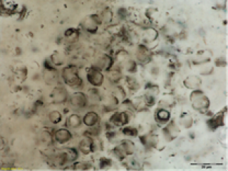 Coccoidal microfossils