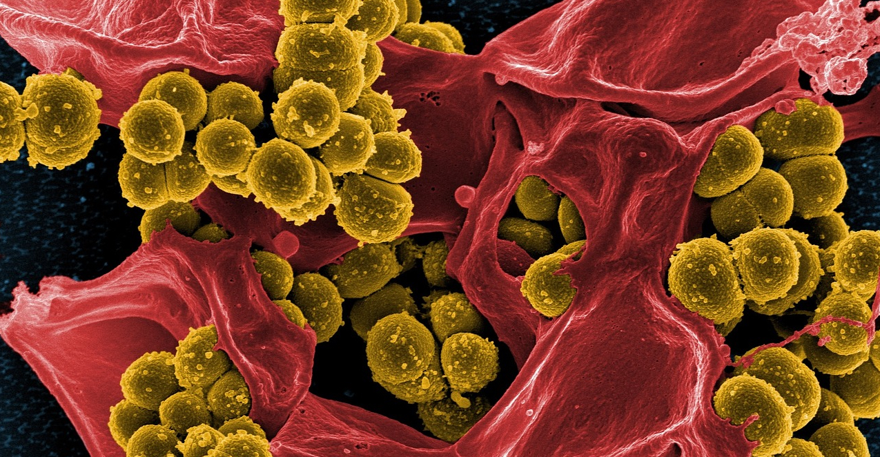 bacteria in tissue