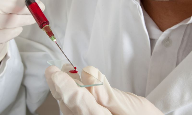New blood test can detect wide range of cancers