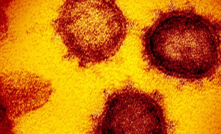 SARS virus close up