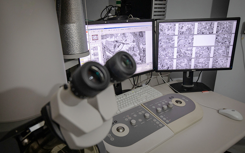 Institute of Ophthalmology Light and Electron Microscopy Unit