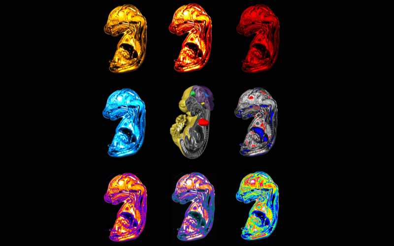Biomedical imaging of developing embryos