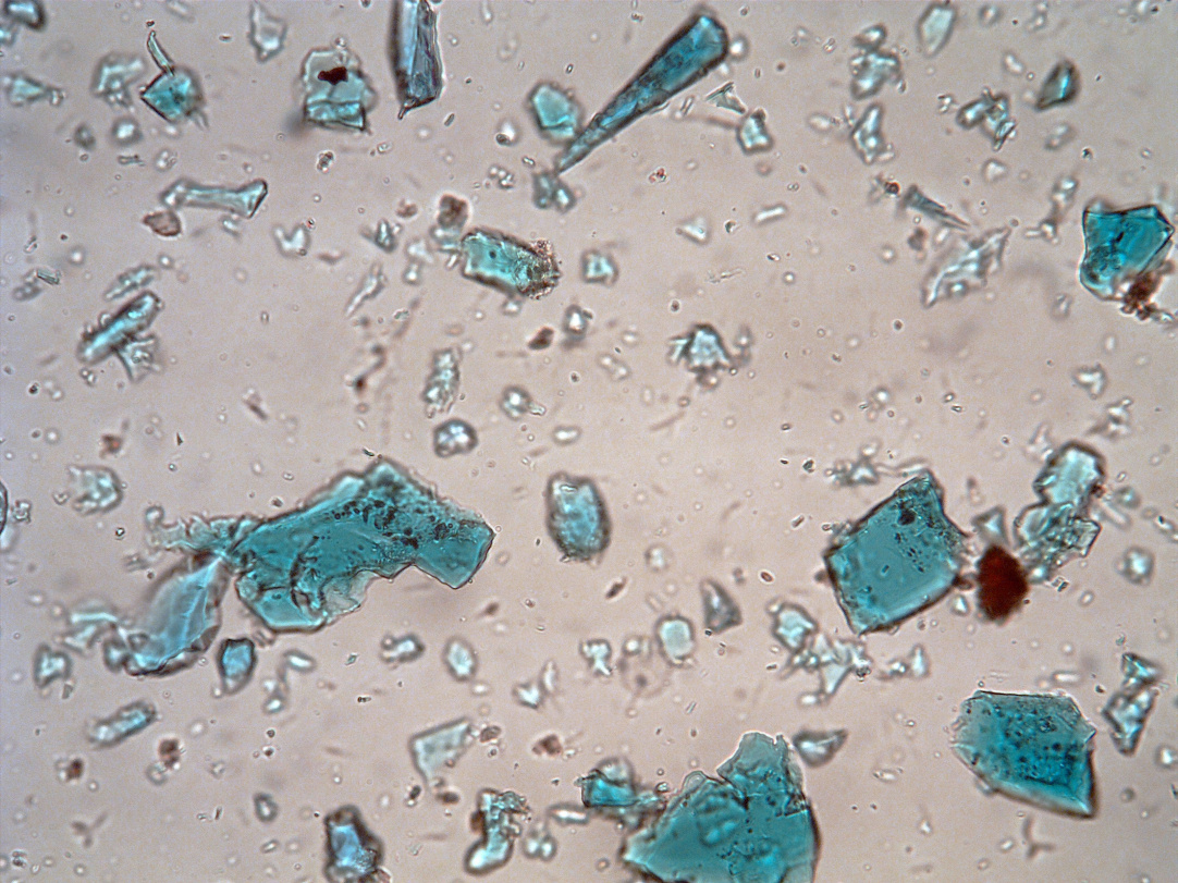 Photomicrograph of crushed azurite used as pigment at Çatalhöyük, Turkey