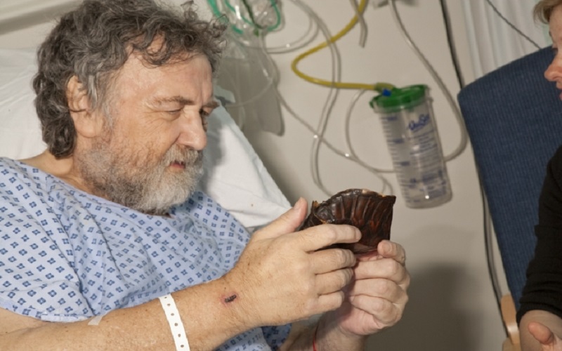 Male patient at University College Hospital holding a museum artefact