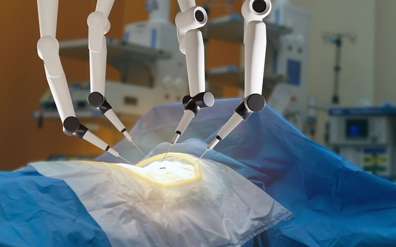 Surgery robotic machine above an incision