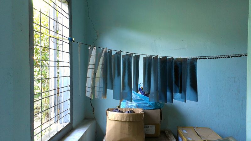 Immage of X-ray films hanging to dry