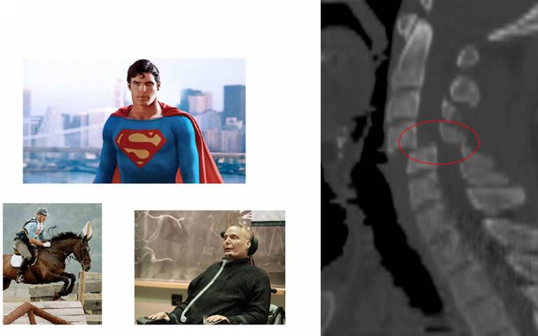 Neck fracture xray alongside pictures of superman