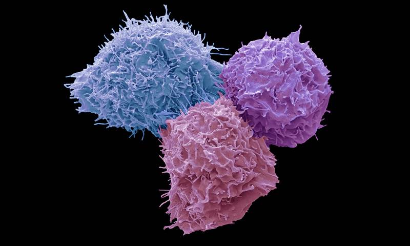 False coloured SEM image of 283T cells in culture. Image is copyrighted. It was taken on SEM by Steve Gschmeissner. To see more of his work, visit http://theworldcloseup.com/
