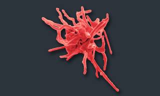 False coloured SEM image of a platelet found as a contaminant in a primary monocyte culture. Image is copyrighted. It was taken on SEM by Steve Gschmeissner. To see more of his work, visit http://theworldcloseup.com/