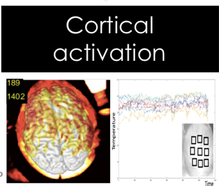 cortical-activation