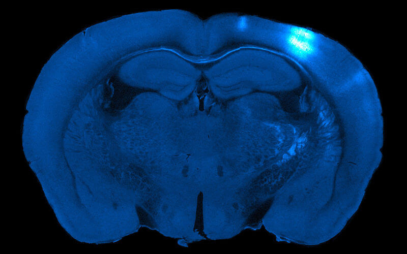 Brain cortex in blue, against black background